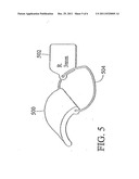 System and Method for Ankle Arthroplasty diagram and image