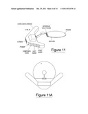 METHOD AND APPARATUS OF REMOTE VIDEO DISTRIBUTION diagram and image