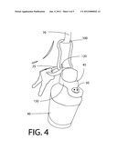 Bottle and Key Clip diagram and image