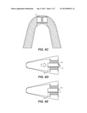 ATHLETIC MOUTH GUARD AND BREATHING TRAINER diagram and image