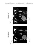 METHOD AND APPARATUS FOR BREATHING ADAPTED IMAGING diagram and image