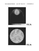 OPTIMIZED APERTURE SELECTION IMAGING COMPUTED TOMOGRAPHY SYSTEM AND METHOD diagram and image