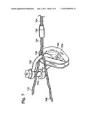 THIMBLE WITH ELEMENT RETAINING FEATURE diagram and image