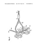 THIMBLE WITH ELEMENT RETAINING FEATURE diagram and image