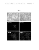 VALPROIC ACID, DERIVATIVES, ANALOGUES, AND COMPOSITIONS INCLUDING SAME AND     METHODS FOR THEIR THERAPEUTIC USE diagram and image