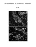 VALPROIC ACID, DERIVATIVES, ANALOGUES, AND COMPOSITIONS INCLUDING SAME AND     METHODS FOR THEIR THERAPEUTIC USE diagram and image