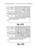 CNS DELIVERY OF THERAPEUTIC AGENTS diagram and image