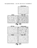 CNS DELIVERY OF THERAPEUTIC AGENTS diagram and image