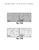 CNS DELIVERY OF THERAPEUTIC AGENTS diagram and image