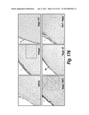 CNS DELIVERY OF THERAPEUTIC AGENTS diagram and image