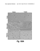 CNS DELIVERY OF THERAPEUTIC AGENTS diagram and image