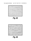 CNS DELIVERY OF THERAPEUTIC AGENTS diagram and image