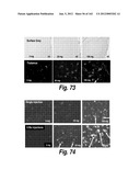 CNS DELIVERY OF THERAPEUTIC AGENTS diagram and image