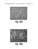 CNS DELIVERY OF THERAPEUTIC AGENTS diagram and image