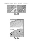 CNS DELIVERY OF THERAPEUTIC AGENTS diagram and image