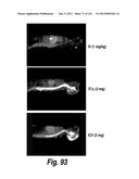 CNS DELIVERY OF THERAPEUTIC AGENTS diagram and image