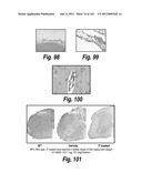 CNS DELIVERY OF THERAPEUTIC AGENTS diagram and image