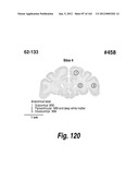 CNS DELIVERY OF THERAPEUTIC AGENTS diagram and image