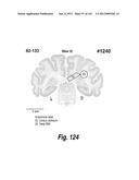 CNS DELIVERY OF THERAPEUTIC AGENTS diagram and image