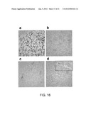 ANGIOGENIC AND IMMUNOLOGIC APPLICATIONS OF ANTI-CD160 SPECIFIC COMPOUNDS     OBTAINABLE FROM mAb CL1-R2 diagram and image