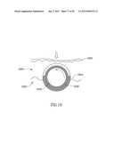 DERMAL MICRO-ORGANS, METHODS AND APPARATUSES FOR PRODUCING AND USING THE     SAME diagram and image