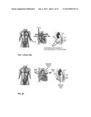 UNIT DOSES, AEROSOLS, KITS, AND METHODS FOR TREATING HEART CONDITIONS BY     PULMONARY ADMINISTRATION diagram and image