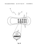 DIAGNOSTIC COMPOSITION AND ARTICLE FOR MONITORING INTRAVAGINAL INFECTIONS diagram and image