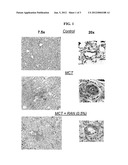 USE OF RANOLAZINE FOR TREATING PULMONARY HYPERTENSION diagram and image