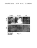 Cancer Cell Targeting Using Nanoparticles diagram and image