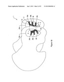 SYSTEMS, DEVICES, AND METHODS FOR SUB-URETHRAL SUPPORT diagram and image