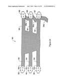 SYSTEMS, DEVICES, AND METHODS FOR SUB-URETHRAL SUPPORT diagram and image