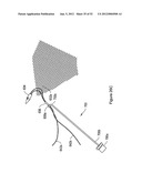 SYSTEMS, DEVICES, AND METHODS FOR SUB-URETHRAL SUPPORT diagram and image