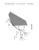 SYSTEMS, DEVICES, AND METHODS FOR SUB-URETHRAL SUPPORT diagram and image