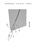 SYSTEMS, DEVICES, AND METHODS FOR SUB-URETHRAL SUPPORT diagram and image