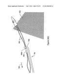 SYSTEMS, DEVICES, AND METHODS FOR SUB-URETHRAL SUPPORT diagram and image