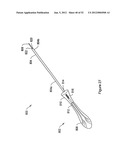 SYSTEMS, DEVICES, AND METHODS FOR SUB-URETHRAL SUPPORT diagram and image