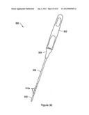 SYSTEMS, DEVICES, AND METHODS FOR SUB-URETHRAL SUPPORT diagram and image