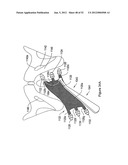 SYSTEMS, DEVICES, AND METHODS FOR SUB-URETHRAL SUPPORT diagram and image