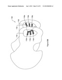 SYSTEMS, DEVICES, AND METHODS FOR SUB-URETHRAL SUPPORT diagram and image