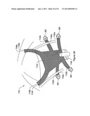 SYSTEMS, DEVICES, AND METHODS FOR SUB-URETHRAL SUPPORT diagram and image