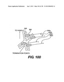 DIRECT DRIVE ENDOSCOPY SYSTEMS AND METHODS diagram and image