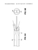 DIRECT DRIVE ENDOSCOPY SYSTEMS AND METHODS diagram and image