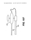 DIRECT DRIVE ENDOSCOPY SYSTEMS AND METHODS diagram and image