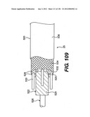 DIRECT DRIVE ENDOSCOPY SYSTEMS AND METHODS diagram and image