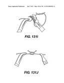 DIRECT DRIVE ENDOSCOPY SYSTEMS AND METHODS diagram and image