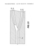 DIRECT DRIVE ENDOSCOPY SYSTEMS AND METHODS diagram and image