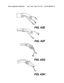 DIRECT DRIVE ENDOSCOPY SYSTEMS AND METHODS diagram and image