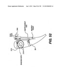 DIRECT DRIVE ENDOSCOPY SYSTEMS AND METHODS diagram and image