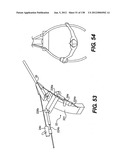 DIRECT DRIVE ENDOSCOPY SYSTEMS AND METHODS diagram and image