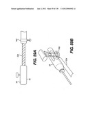 DIRECT DRIVE ENDOSCOPY SYSTEMS AND METHODS diagram and image